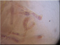Groer Dickstiel-Kotling - Ascobolus lignatilis