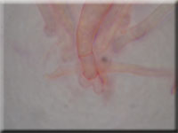 Bartloses Stängelbecherchen - Hymenoscyphus imberbis