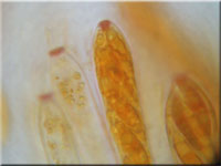 Gelbes Drechselstielbecherchen - Allophylaria herbicola