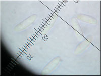 Blasses Erlenbecherchen - Calycellina alniella