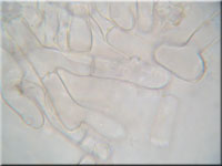 Bactridium flavum