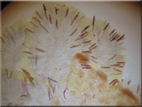 Großer Dickstiel-Kotling - Ascobolus lignatilis