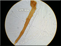 Halbkugeliger Borstenbecherling - Humaria hemisphaerica