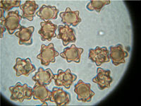Sternsporiger Risspilz - Inocybe asterospora