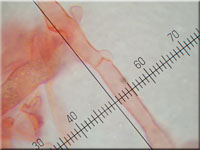 Schildflechten-Nabeling - Omphalina peltigerina