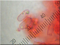 Eichen-Zähnchenrindenpilz - Xylodon quercinus