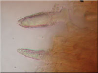 Eichen-Zystidenrindenpilz - Peniophora quercina