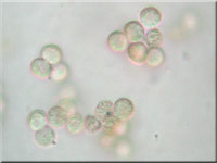 Stäublings-Schleimpilz - Reticularia lycoperdon